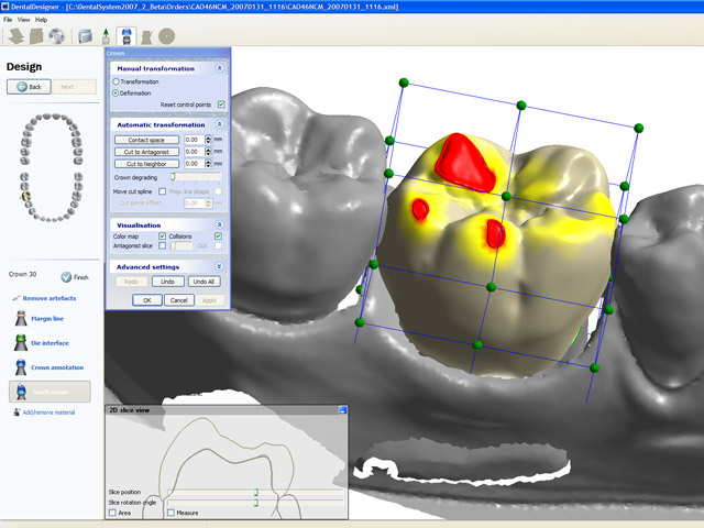 cad-cam