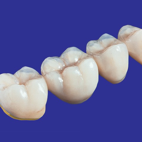 zirkonoxid zirkonoxid